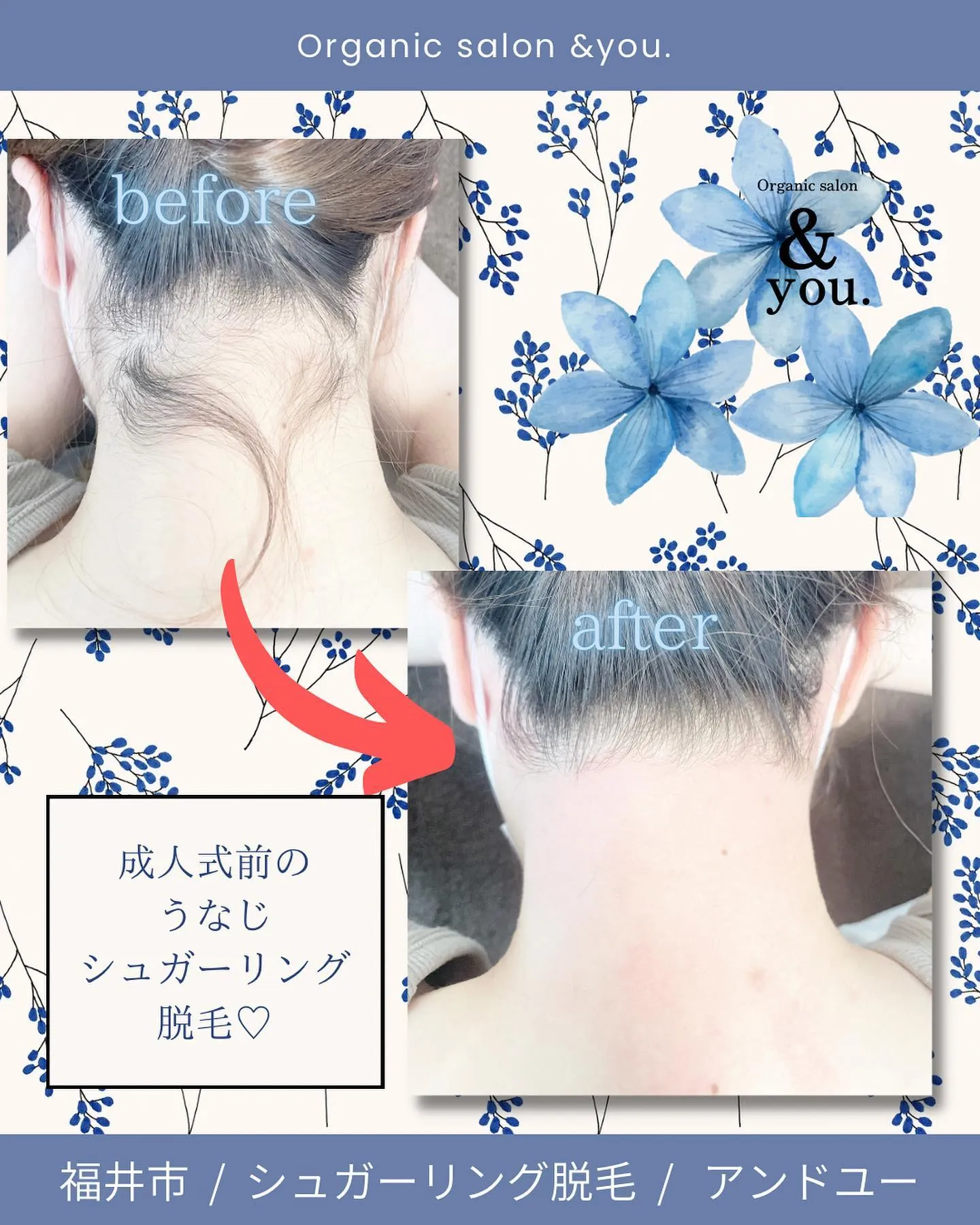 【うなじラッシュ✨️】
